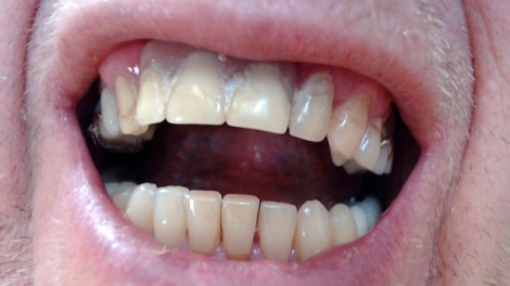 Dental Malpractice Attorney U.: Experts
