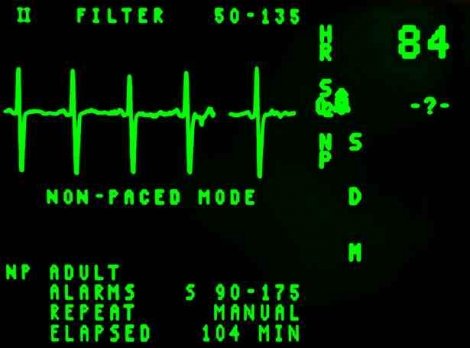 Medical Error Case