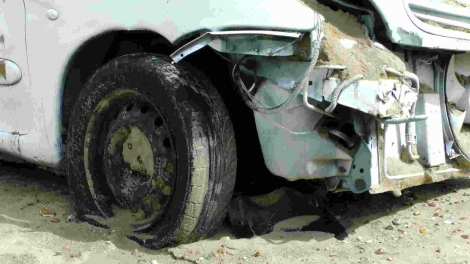 FAQ – What If You Committed Negligence Too?